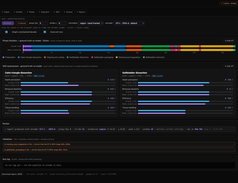 A colour-coded step timeline laid against the reference version of the procedure